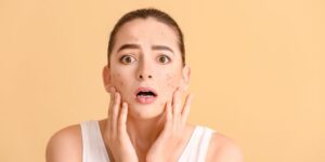 What Are the Best Tips for Reducing Acne and Breakouts?